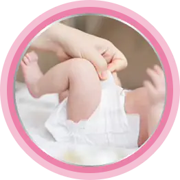 Что такое опрелости у новорожденных?