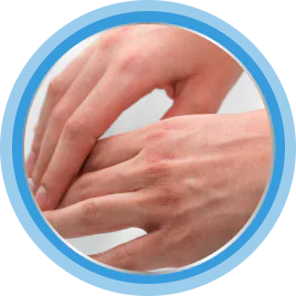 Трещины на коже рук